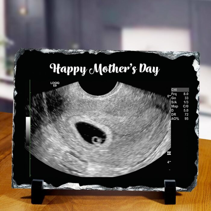 Personalized Happy Mothers Day Ultrasound Stone